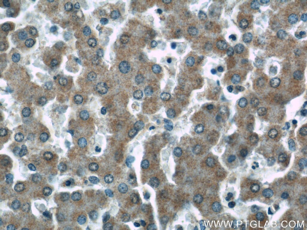 Immunohistochemistry (IHC) staining of human liver tissue using HSD3B7 Polyclonal antibody (10488-1-AP)