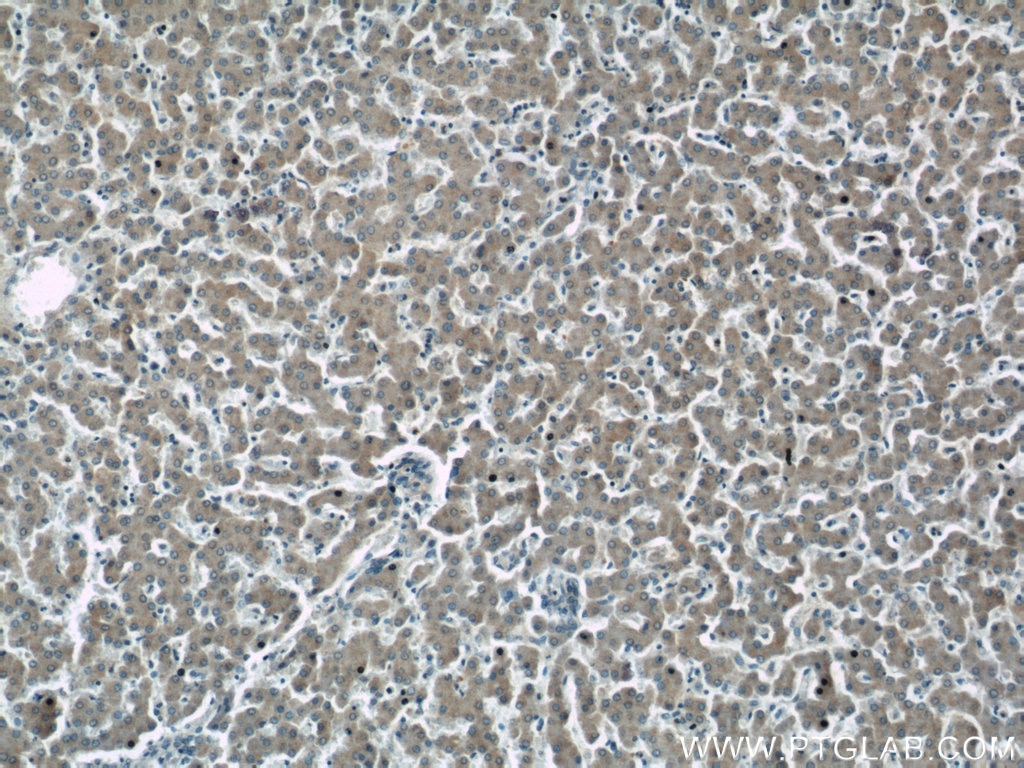 Immunohistochemistry (IHC) staining of human liver tissue using HSD3B7 Polyclonal antibody (10488-1-AP)