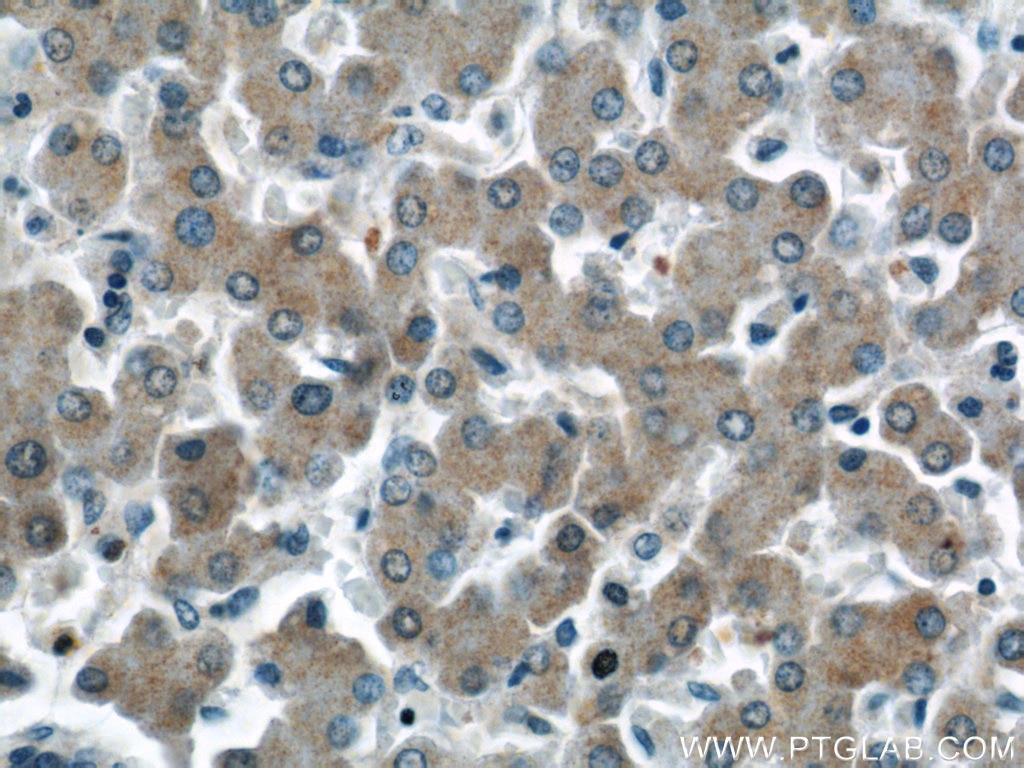 Immunohistochemistry (IHC) staining of human liver tissue using HSD3B7 Polyclonal antibody (10488-1-AP)