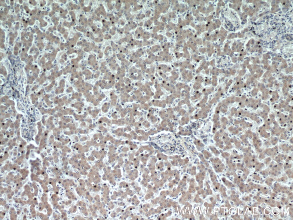 Immunohistochemistry (IHC) staining of human liver tissue using HSD3B7 Polyclonal antibody (10488-1-AP)