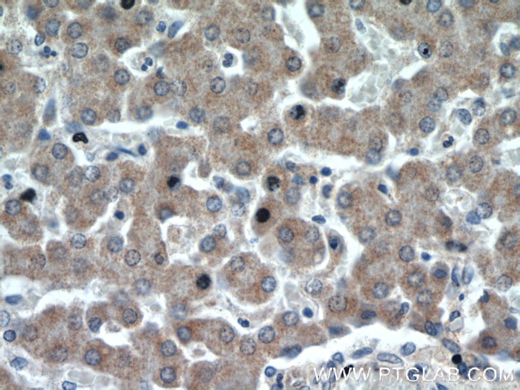 Immunohistochemistry (IHC) staining of human liver tissue using HSD3B7 Polyclonal antibody (10488-1-AP)