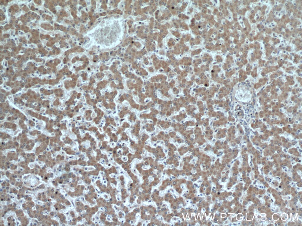 Immunohistochemistry (IHC) staining of human liver tissue using HSD3B7 Polyclonal antibody (10488-1-AP)