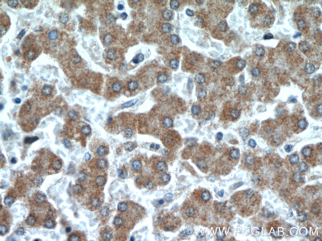 Immunohistochemistry (IHC) staining of human liver tissue using HSD3B7 Polyclonal antibody (10488-1-AP)