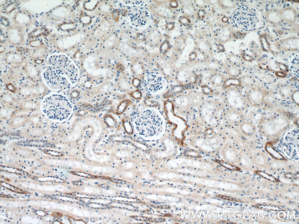 Immunohistochemistry (IHC) staining of human kidney tissue using HSD3B7 Polyclonal antibody (10488-1-AP)