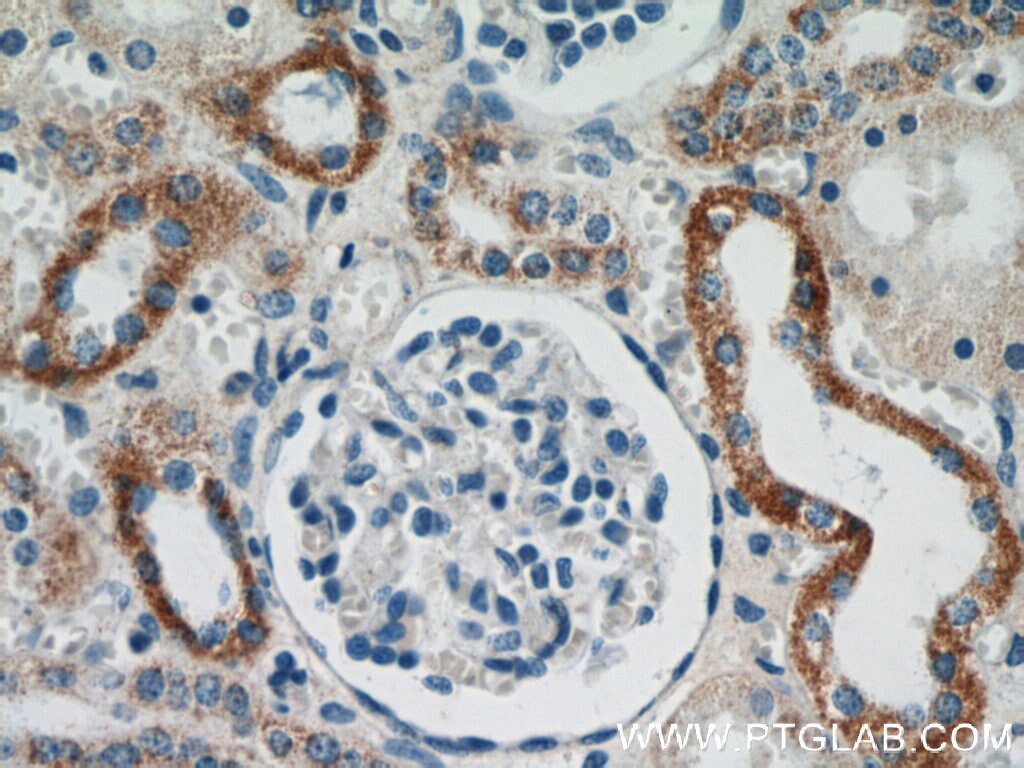 Immunohistochemistry (IHC) staining of human kidney tissue using HSD3B7 Polyclonal antibody (10488-1-AP)