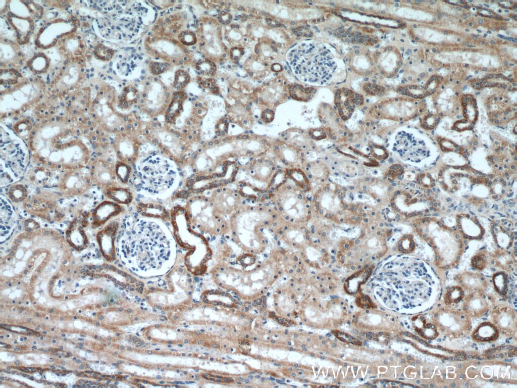 Immunohistochemistry (IHC) staining of human kidney tissue using HSD3B7 Polyclonal antibody (10488-1-AP)