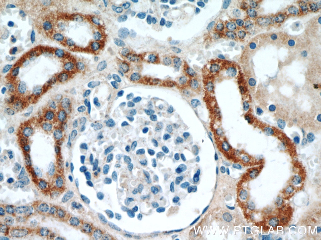 Immunohistochemistry (IHC) staining of human kidney tissue using HSD3B7 Polyclonal antibody (10488-1-AP)