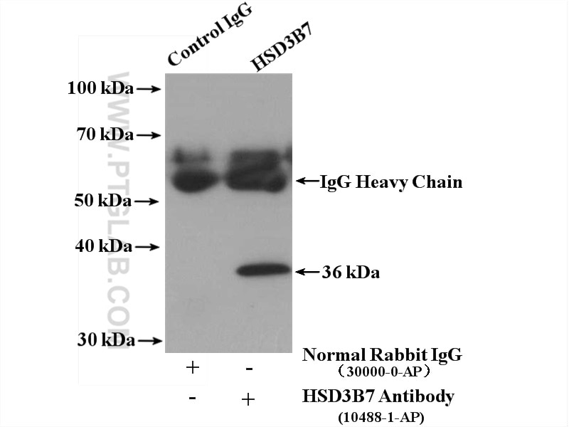 Immunoprecipitation (IP) experiment of mouse liver tissue using HSD3B7 Polyclonal antibody (10488-1-AP)