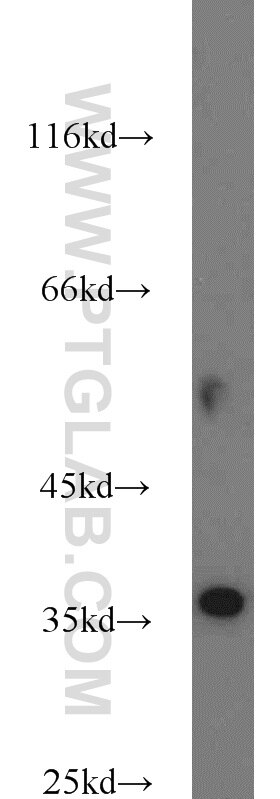 Western Blot (WB) analysis of mouse liver tissue using HSD3B7 Polyclonal antibody (10488-1-AP)