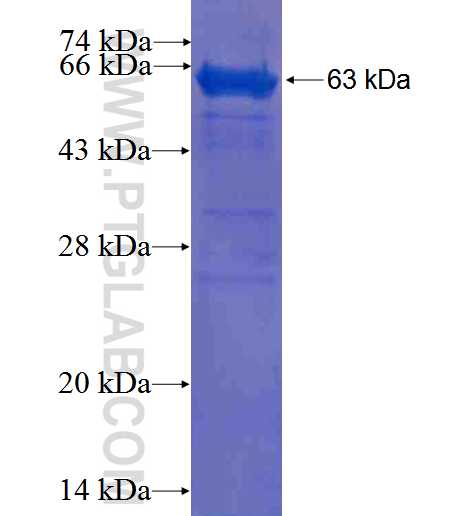 HSD3B7 fusion protein Ag0755 SDS-PAGE