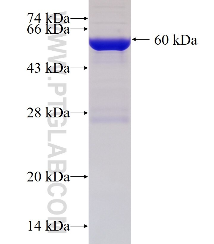 HSD3B7 fusion protein Ag0755 SDS-PAGE