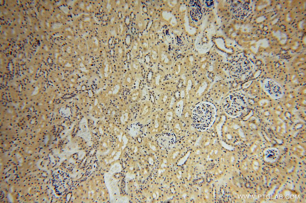 Immunohistochemistry (IHC) staining of human kidney tissue using HSDL1 Polyclonal antibody (16988-1-AP)