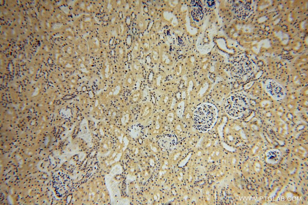 Immunohistochemistry (IHC) staining of human kidney tissue using HSDL1 Polyclonal antibody (16988-1-AP)