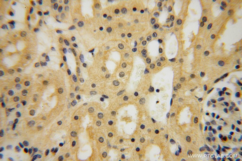 Immunohistochemistry (IHC) staining of human kidney tissue using HSDL1 Polyclonal antibody (16988-1-AP)