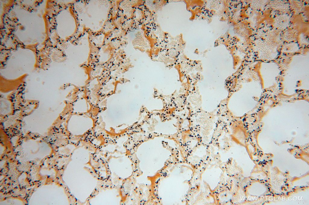 IHC staining of human lung using 16988-1-AP