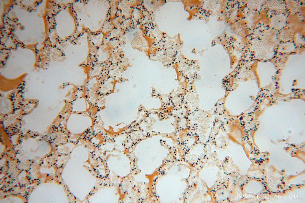 Immunohistochemistry (IHC) staining of human lung tissue using HSDL1 Polyclonal antibody (16988-1-AP)