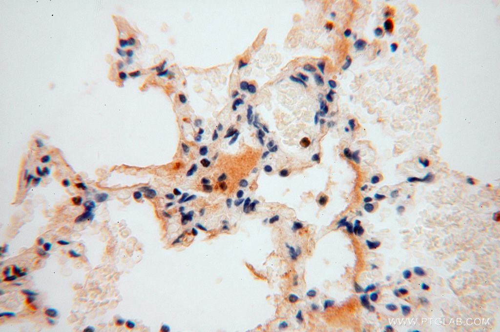 Immunohistochemistry (IHC) staining of human lung tissue using HSDL1 Polyclonal antibody (16988-1-AP)