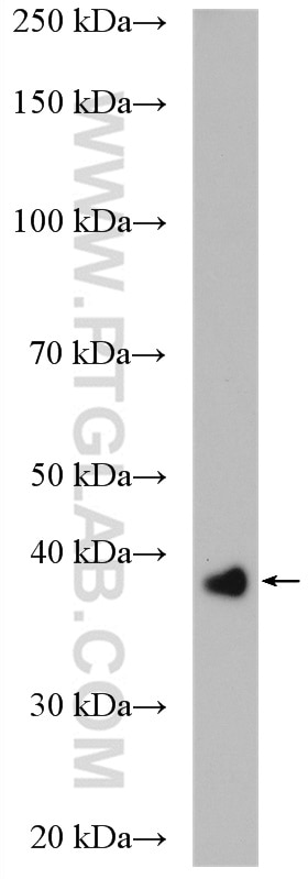 Western Blot (WB) analysis of fetal human brain tissue using HSDL1 Polyclonal antibody (16988-1-AP)