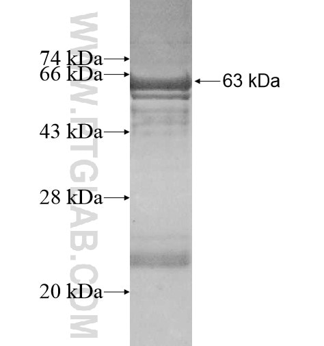 HSDL1 fusion protein Ag10588 SDS-PAGE