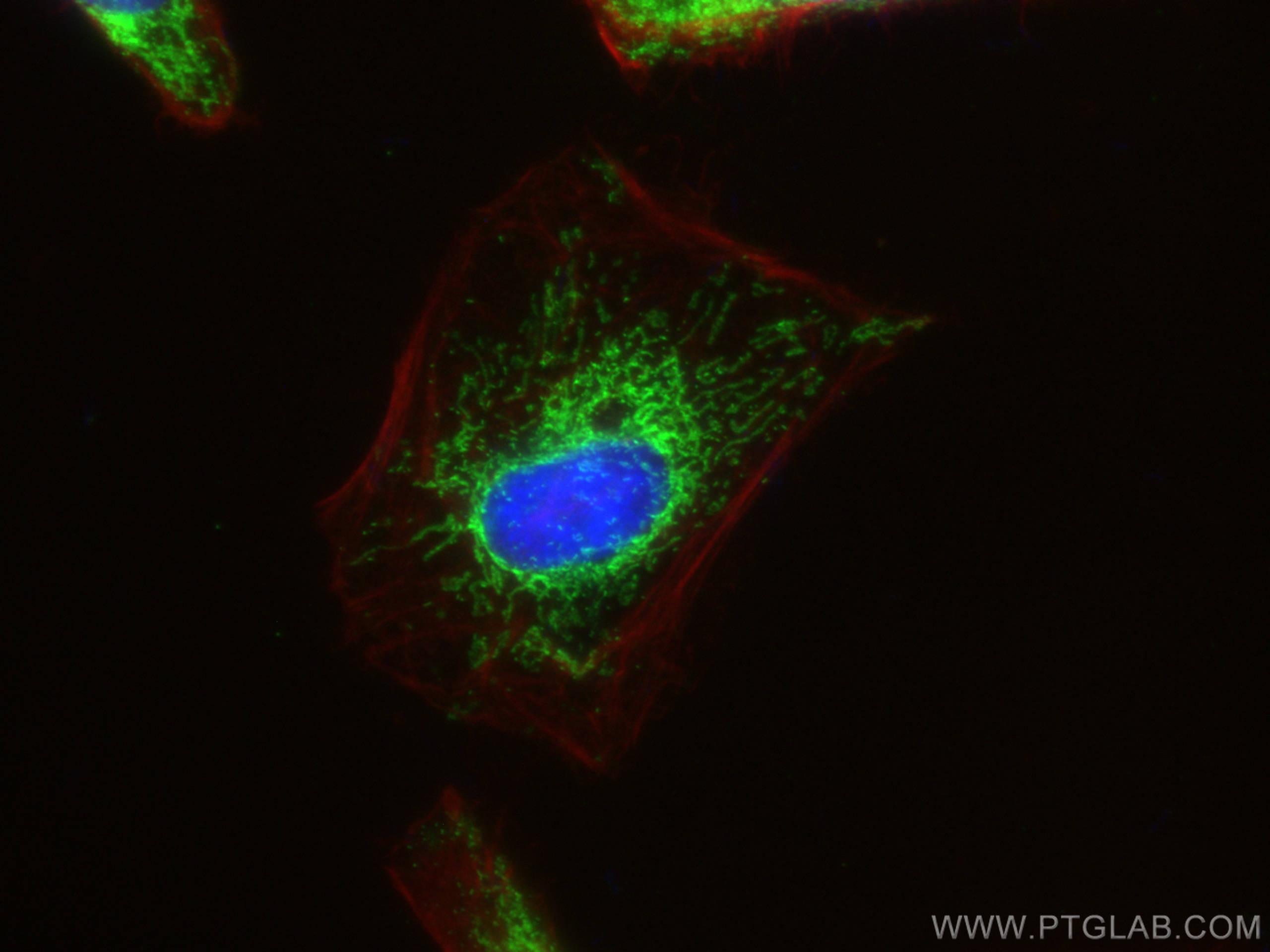 Immunofluorescence (IF) / fluorescent staining of HeLa cells using HSDL2 Polyclonal antibody (15631-1-AP)