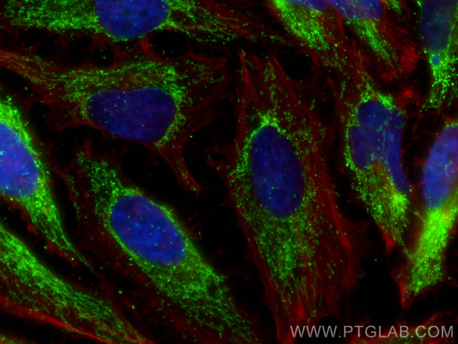 Immunofluorescence (IF) / fluorescent staining of HeLa cells using HSDL2 Monoclonal antibody (68414-1-Ig)