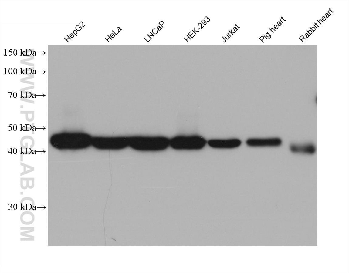 Western Blot (WB) analysis of various lysates using HSDL2 Monoclonal antibody (68414-1-Ig)