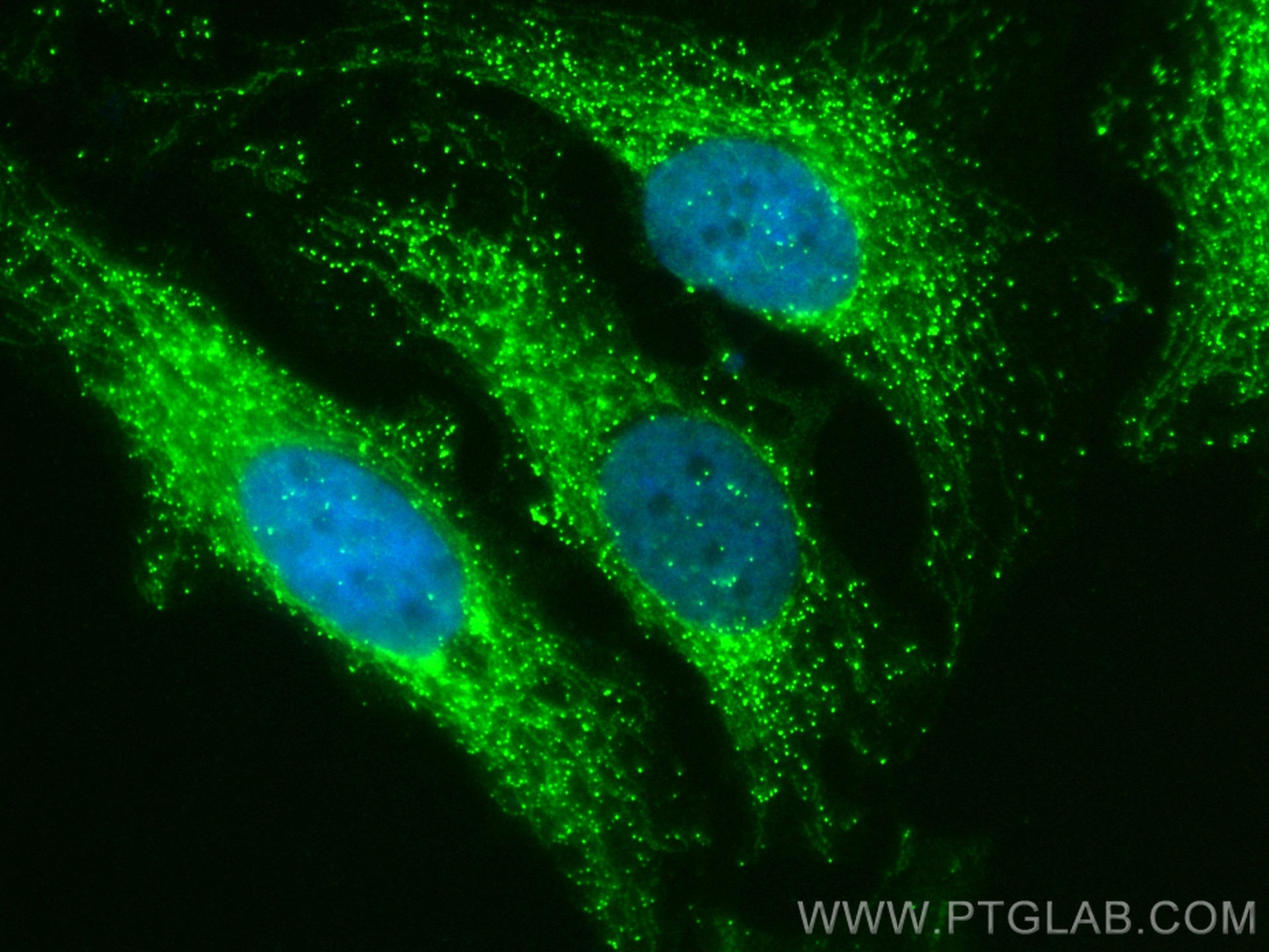 Immunofluorescence (IF) / fluorescent staining of HeLa cells using CoraLite® Plus 488-conjugated HSDL2 Polyclonal ant (CL488-15631)