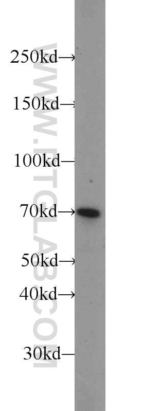 Western Blot (WB) analysis of mouse testis tissue using HSF1 Polyclonal antibody (16107-1-AP)