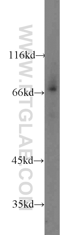Western Blot (WB) analysis of mouse kidney tissue using HSF1 Polyclonal antibody (16107-1-AP)