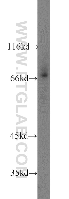 WB analysis of mouse kidney using 16107-1-AP