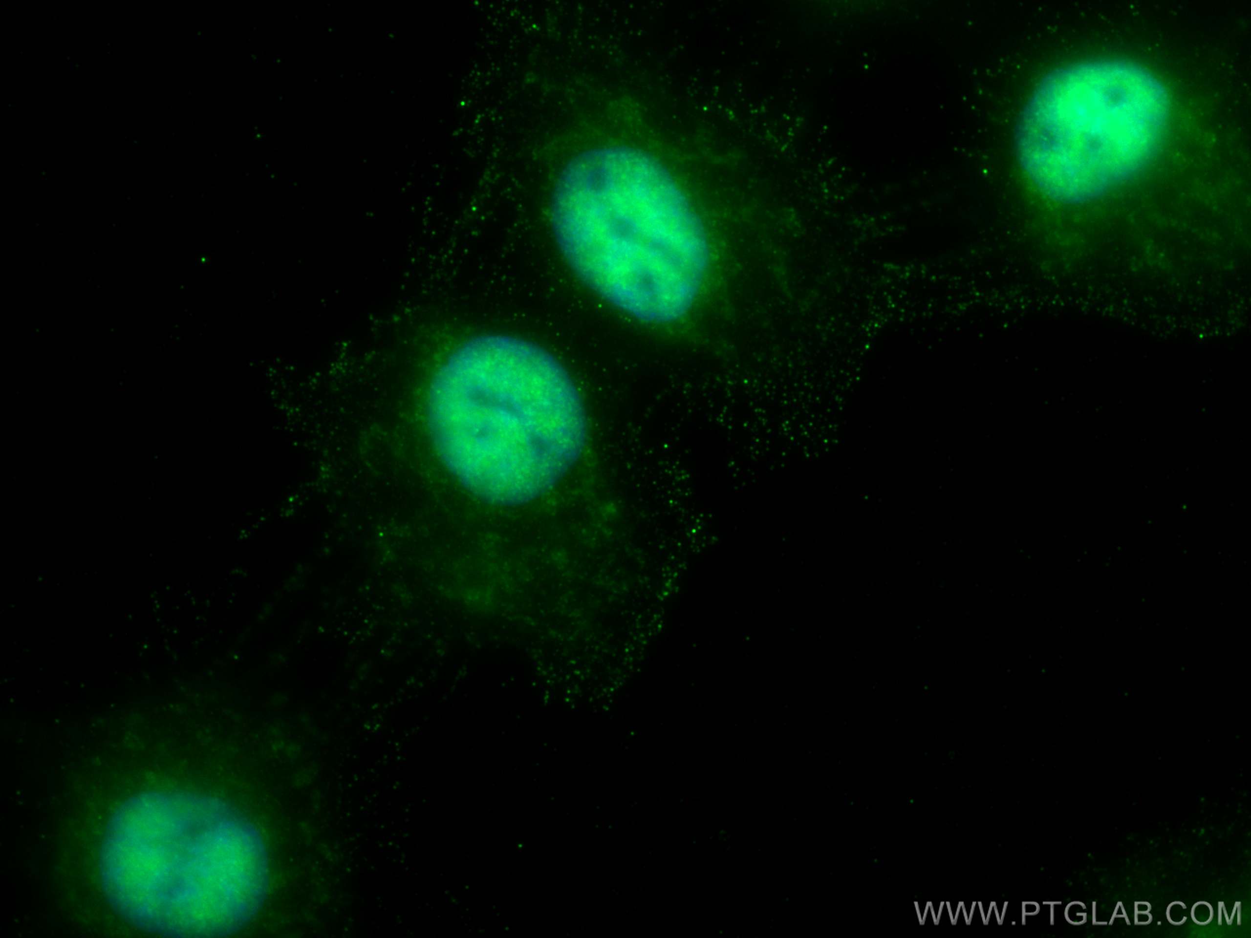 Immunofluorescence (IF) / fluorescent staining of A431 cells using HSF1 Polyclonal antibody (51034-1-AP)