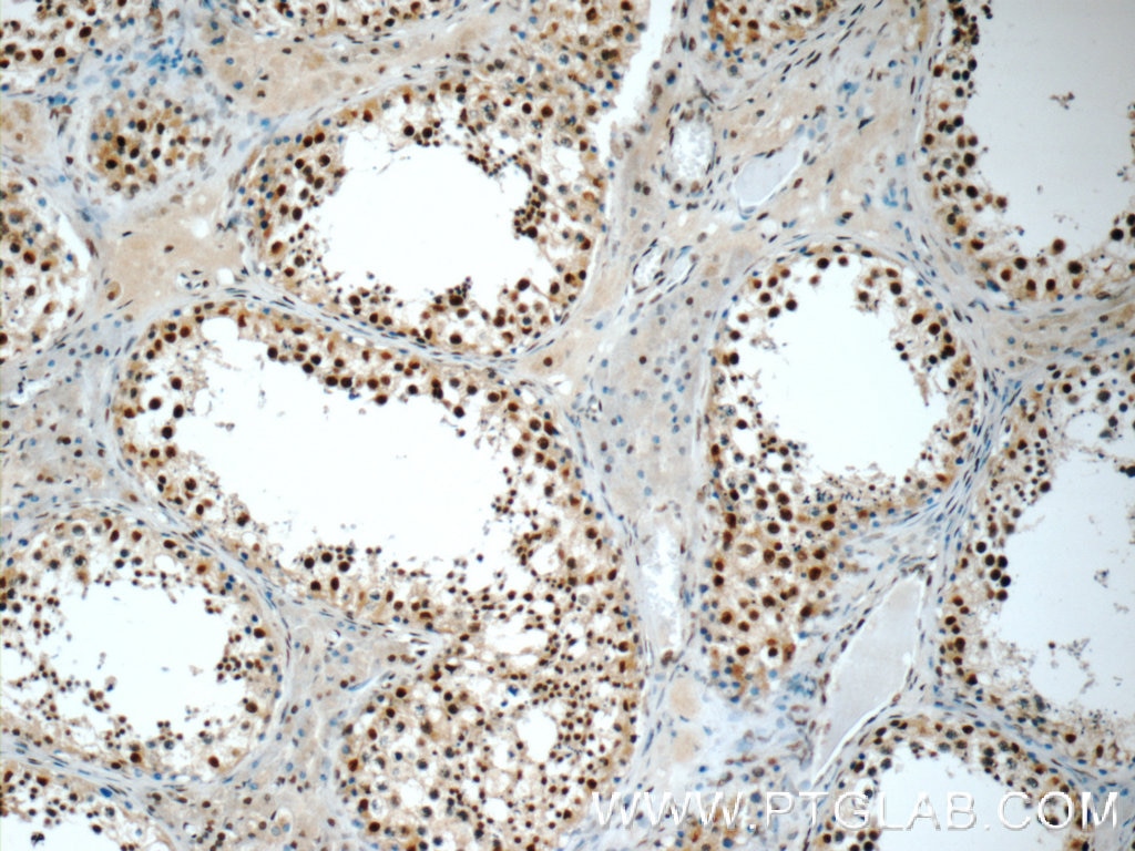 Immunohistochemistry (IHC) staining of human testis tissue using HSF1 Polyclonal antibody (51034-1-AP)