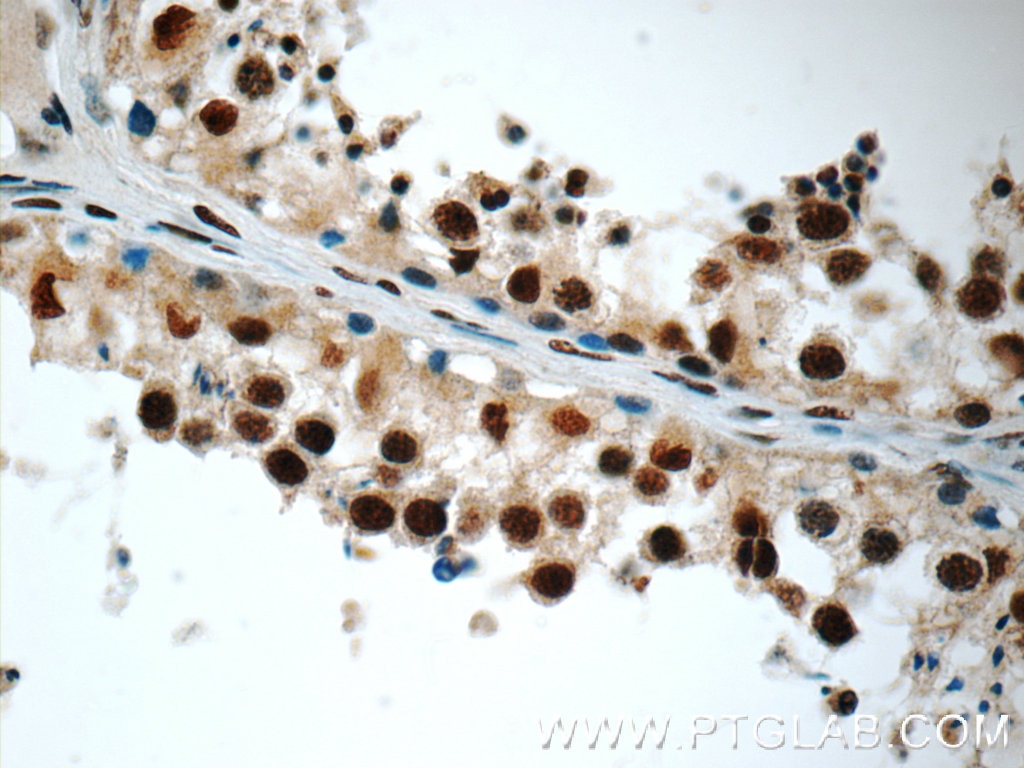 IHC staining of human testis using 51034-1-AP