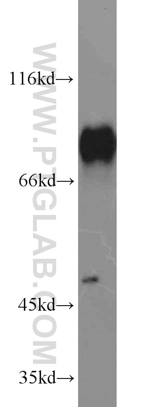Western Blot (WB) analysis of A431 cells using HSF1 Polyclonal antibody (51034-1-AP)