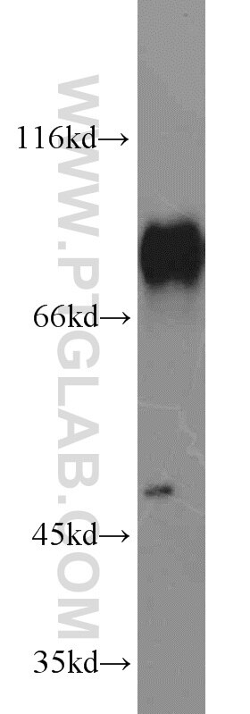 WB analysis of A431 using 51034-1-AP