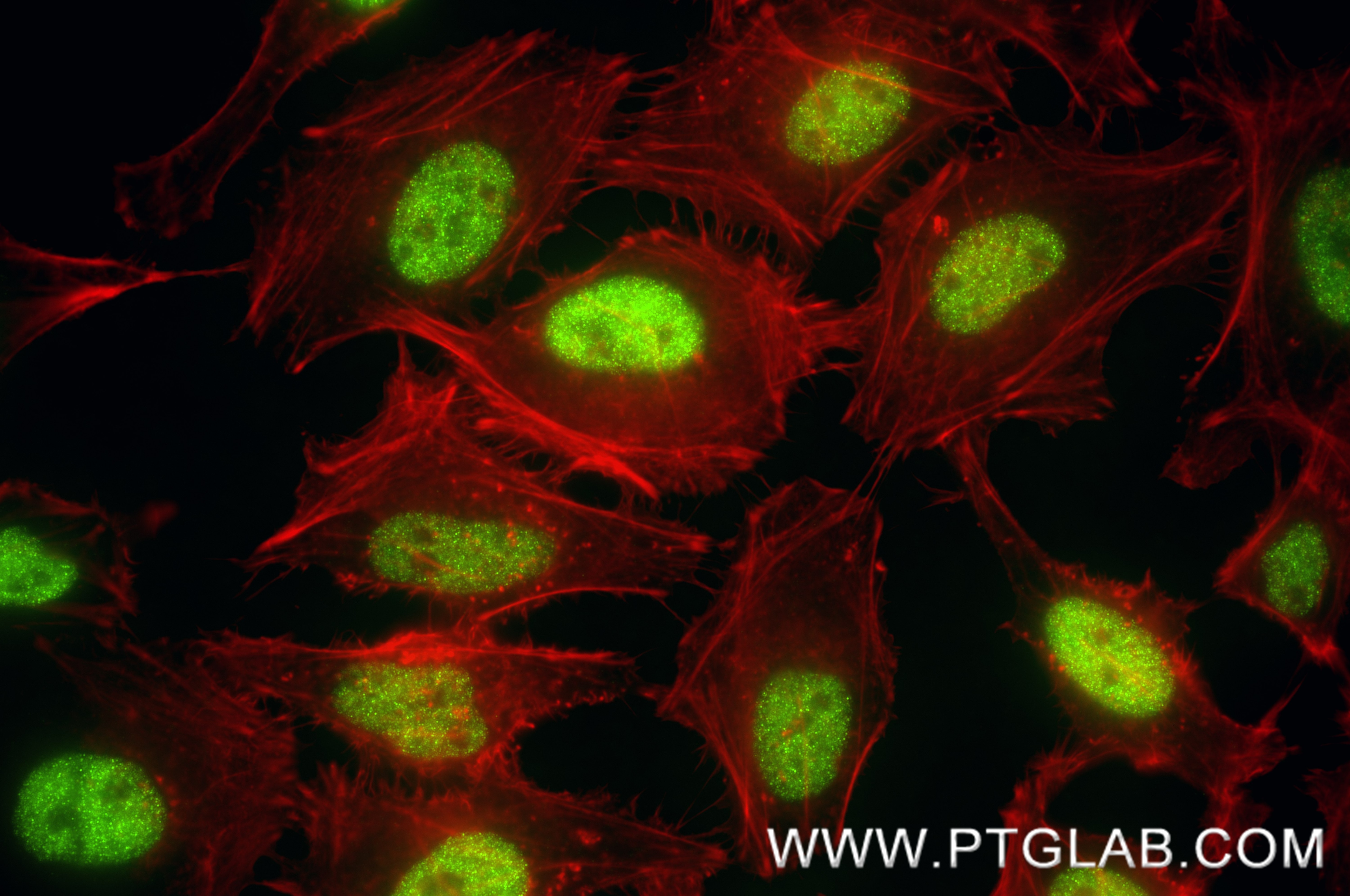 IF Staining of HeLa using 88318-1-RR (same clone as 88318-1-PBS) Immunofluorescence (IF) / fluorescent staining of HeLa cells using HSF1 Recombinant monoclonal antibody (88318-1-RR)