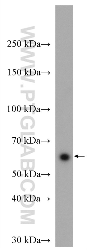 Western Blot (WB) analysis of Jurkat cells using HSF2 Polyclonal antibody (10706-1-AP)