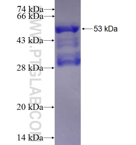 HSF2 fusion protein Ag1067 SDS-PAGE