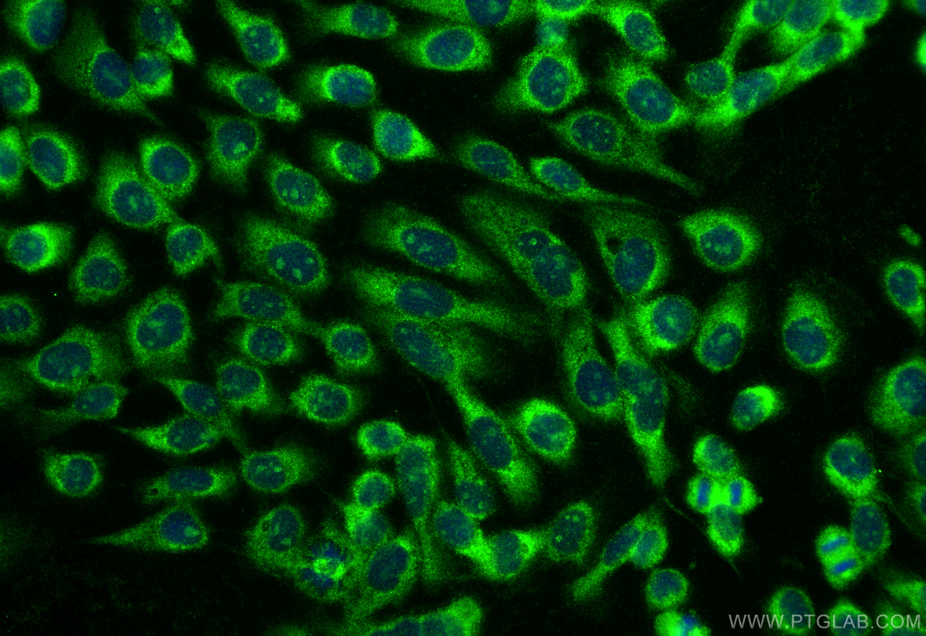 Immunofluorescence (IF) / fluorescent staining of A431 cells using HSF2BP Polyclonal antibody (32594-1-AP)
