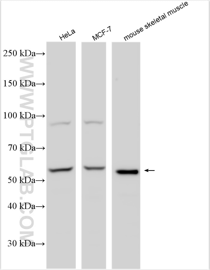 Western Blot (WB) analysis of various lysates using HSF4 Polyclonal antibody (18797-1-AP)