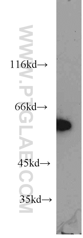 Western Blot (WB) analysis of mouse skeletal muscle tissue using HSF4 Polyclonal antibody (18797-1-AP)