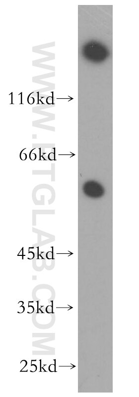 Western Blot (WB) analysis of human skeletal muscle tissue using HSF4 Polyclonal antibody (18797-1-AP)