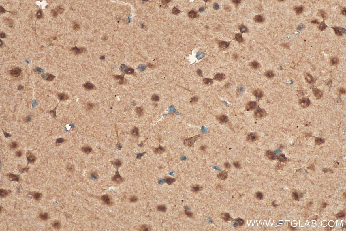 Immunohistochemistry (IHC) staining of mouse brain tissue using HSF4 Polyclonal antibody (22883-1-AP)