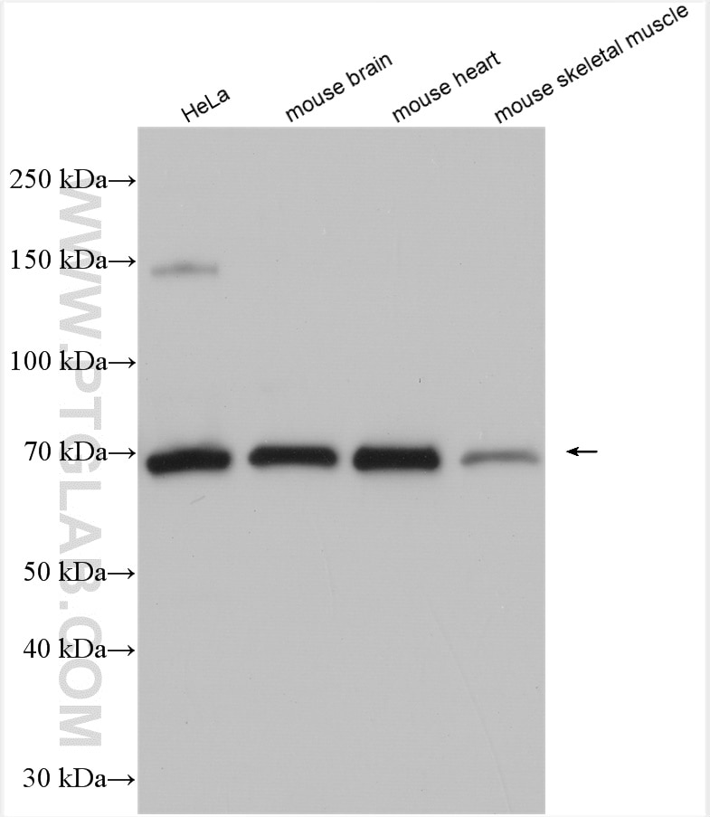 Western Blot (WB) analysis of various lysates using HSF4 Polyclonal antibody (22883-1-AP)