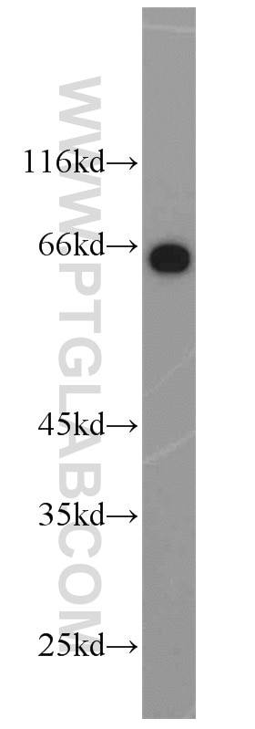 Western Blot (WB) analysis of HeLa cells using HSF4 Polyclonal antibody (22883-1-AP)
