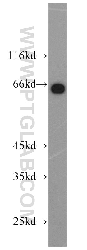 WB analysis of HeLa using 22883-1-AP