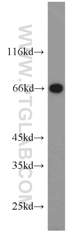 Western Blot (WB) analysis of human brain tissue using HSF4 Polyclonal antibody (22883-1-AP)