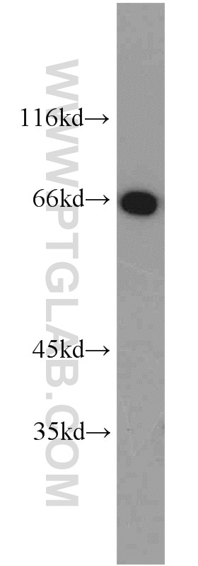 Western Blot (WB) analysis of mouse brain tissue using HSF4 Polyclonal antibody (22883-1-AP)