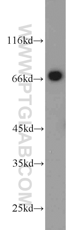 Western Blot (WB) analysis of rat brain tissue using HSF4 Polyclonal antibody (22883-1-AP)