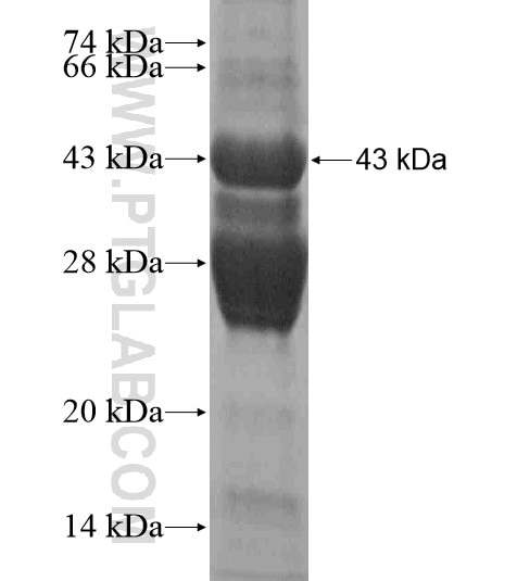 HSF4 fusion protein Ag18935 SDS-PAGE